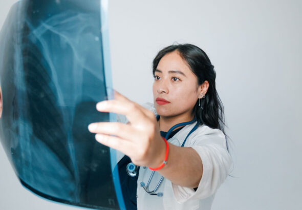 Ceara-deve-registrar-14-mil-casos-de-cancer-de-pulmao-1200x800
